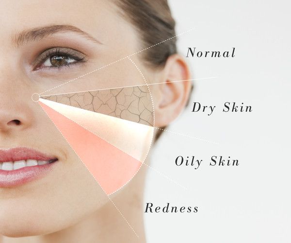 Skincare Tips for Every Skin Type